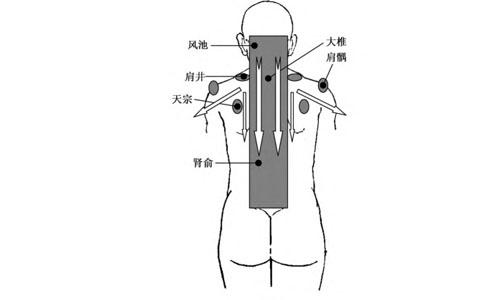 颈椎痛刮痧有作用吗 颈椎疼可以刮痧吗可以起到什么作用