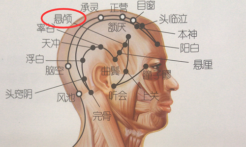 悬颅的准确位置图（悬颅的准确位置图片）