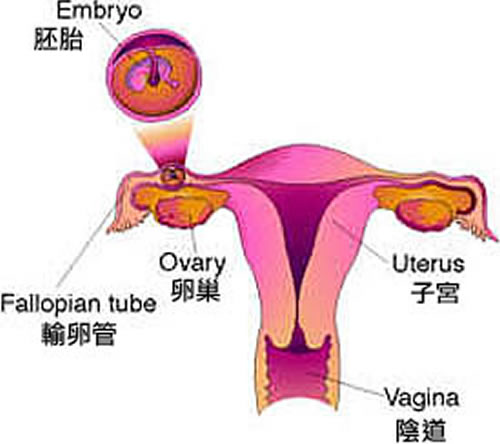 什么是宫外孕 什么是宫外孕可以生吗