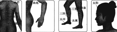 拔罐降血压的方法 拔罐放血降血压