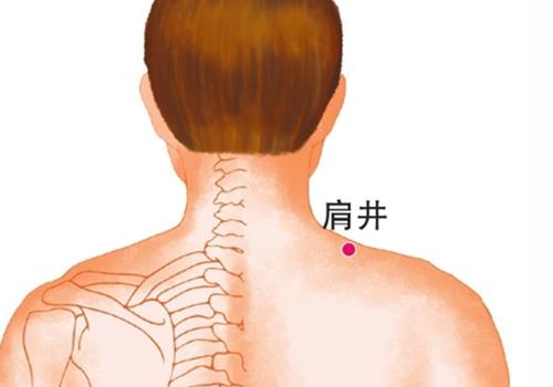 乳腺增生拔罐方法图 乳腺增生怎么拔罐疏通