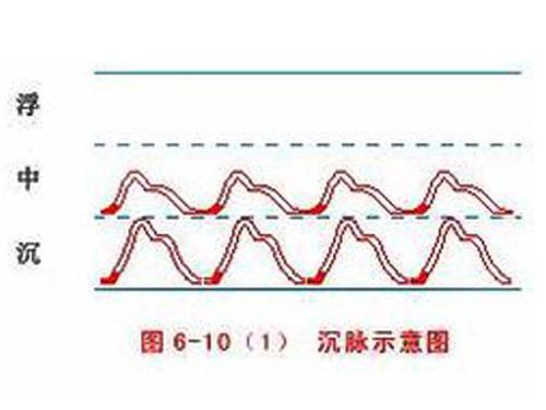 脉象沉是什么意思（脉象很沉是什么意思）