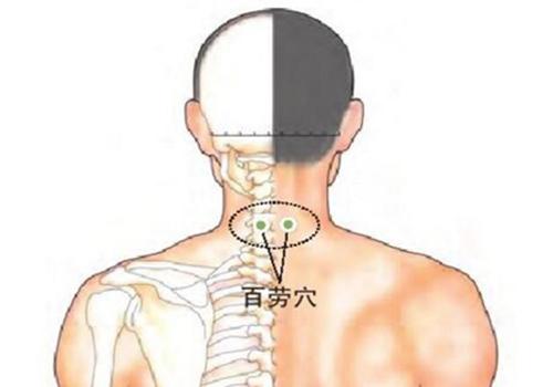 阴囊湿疹会出现脱皮吗 阴囊湿疹开始脱皮是快好了吗