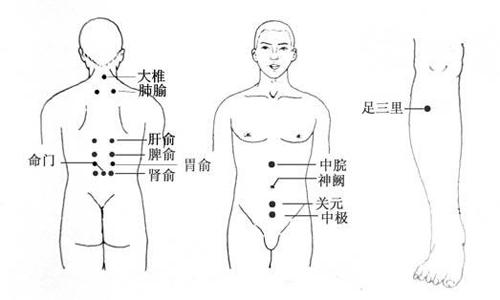 刮痧催经的方法图解（经期刮痧拔罐）