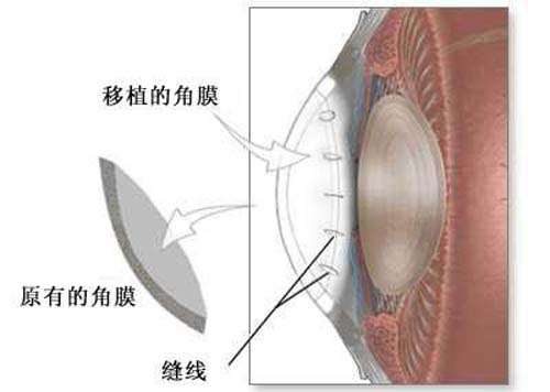 眼角膜是什么（眼角膜是什么样子的图片）