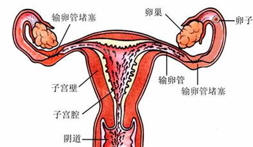 输卵管堵塞的表现