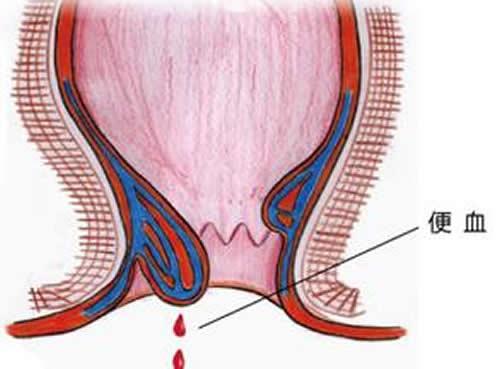 产后便血怎么回事（产妇产后便血）