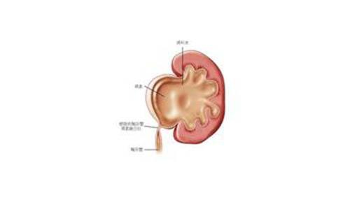 肾积水有哪些症状 肾积水有哪些症状 男性