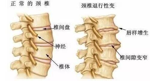 腰酸背痛是什么原因引起的 腰酸背痛是什么原因引起的女人