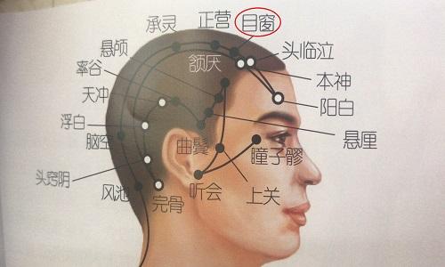 目窗的准确位置图（目窗的准确位置图片）