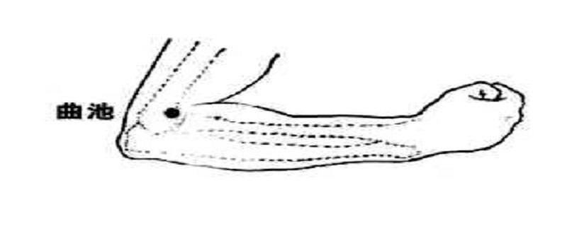 曲池针刺方法 针灸曲池的针法