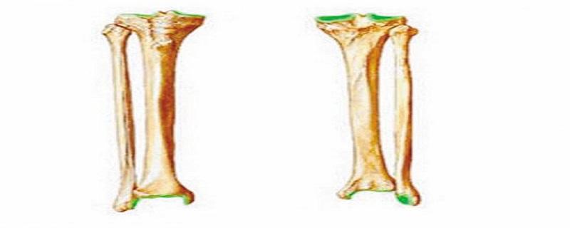 胫骨腓骨的区分 胫骨和腓骨的区分
