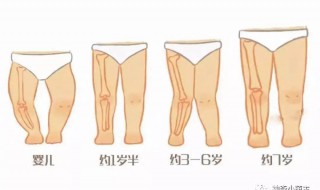 学生0型腿怎么矫正（小宝宝o型腿矫正最有效的方法）