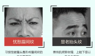 抬头纹太深怎么改善（抬头纹太重该如何解决）