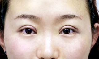 单眼皮怎么弄双眼皮? 单眼皮怎么弄双眼皮好看