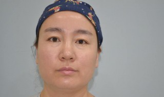 毛孔粗大的人该怎么护肤? 毛孔粗大的人该怎么护肤最好