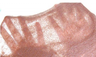 敷完海藻面膜后脸发痒如何止痒 敷海藻面膜后脸红发痒,什么原因