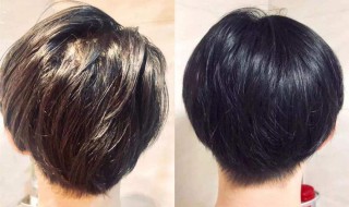 怎么去头油（怎么去头油最有效）