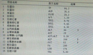 胆汁由什么分泌（胆汁是由肝脏还是胆囊产生的）