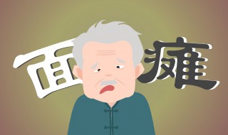 面瘫是什么（面瘫是什么症状）