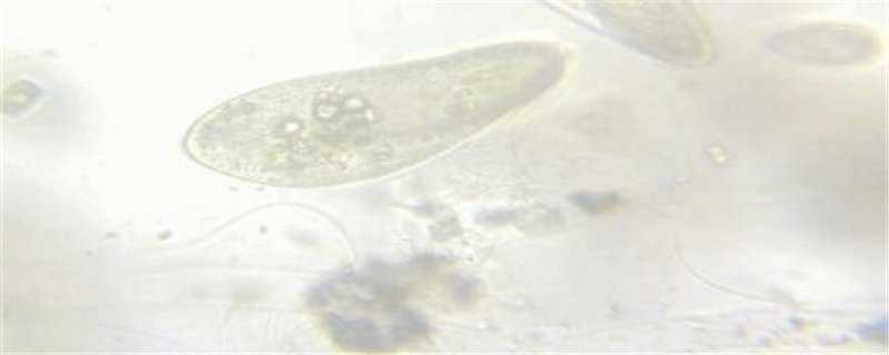 草履虫怎么繁殖 草履虫怎么繁殖快