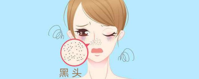 黑头怎么去除的简单方法（黑头 怎么去除）