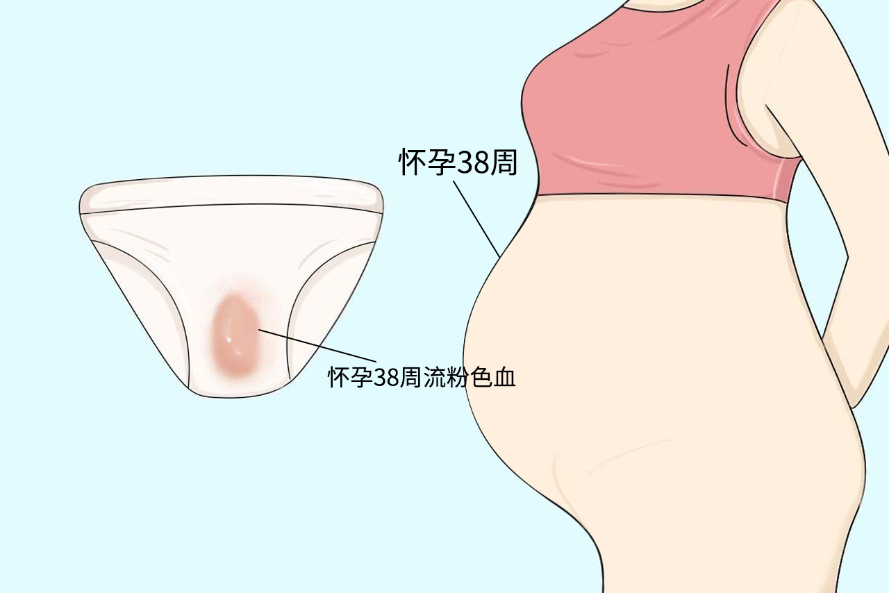 孕38周粉色分泌物图片