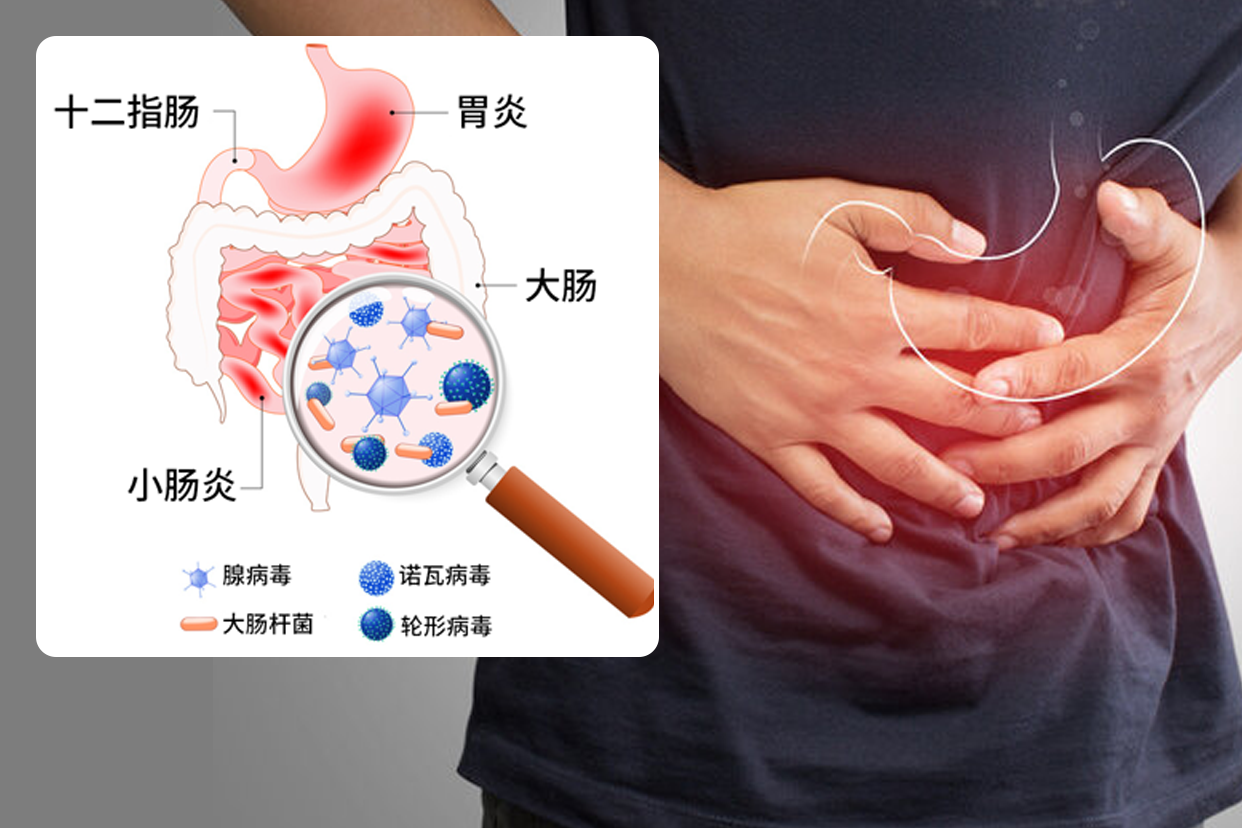 急性胃炎图片 急性胃炎图片做胃镜图片