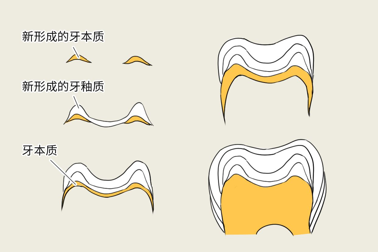 牙本质生长线图片 牙本质生长线形成原因