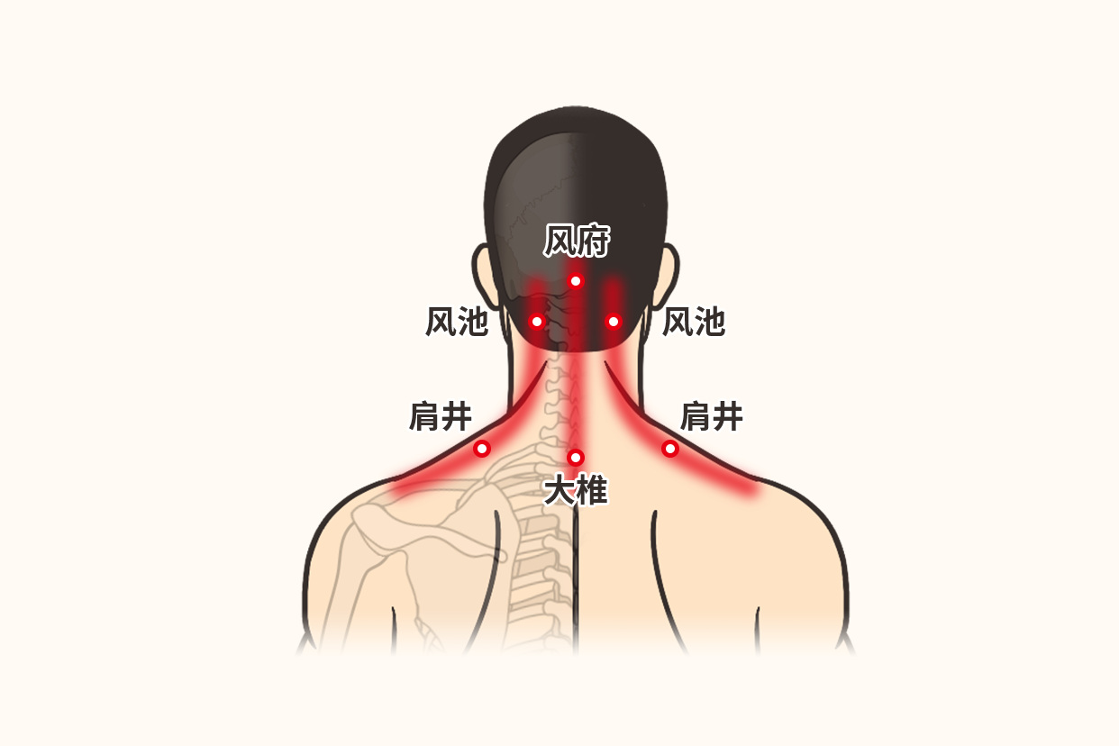 感冒头痛刮痧刮什么部位图（头疼感冒刮痧刮哪个部位图）