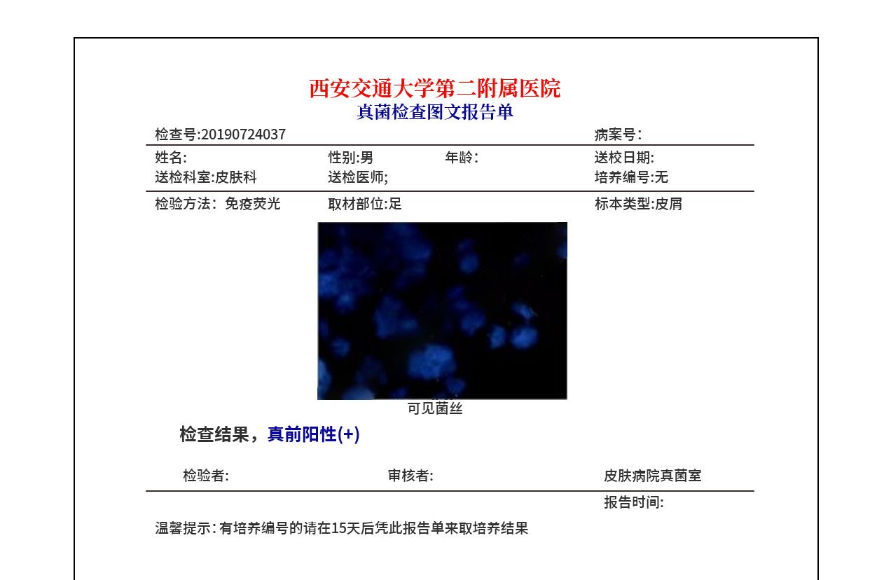 真菌检查报告单图片 真菌检查报告单图片高清