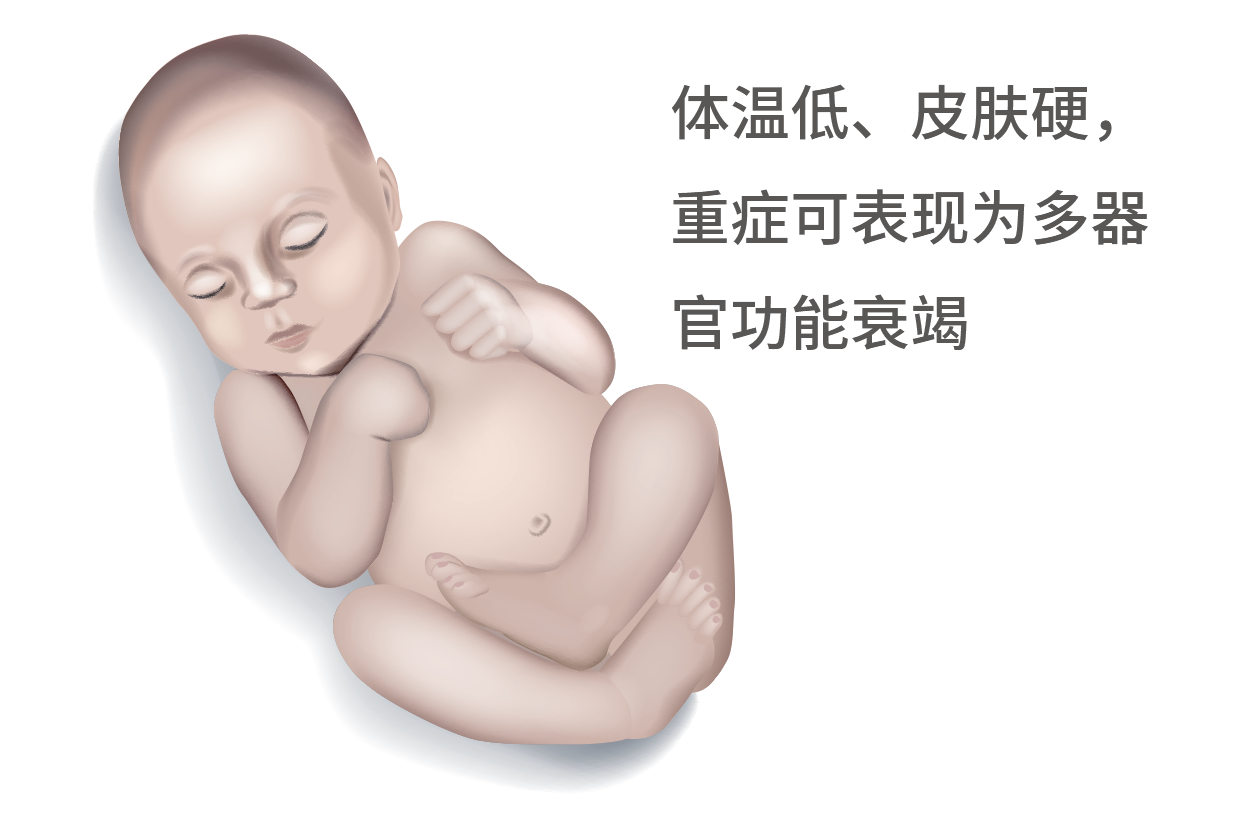 寒冷损伤综合症图片（寒冷损伤综合症图片）