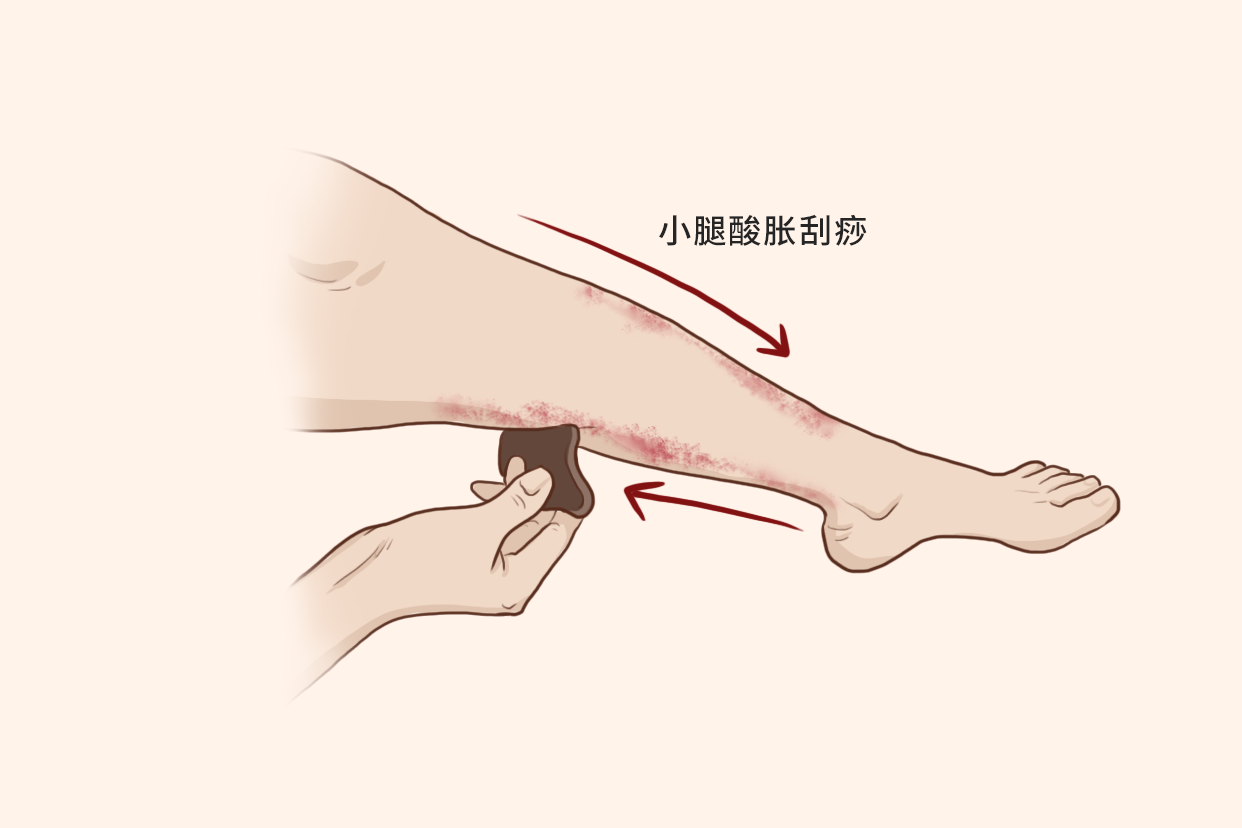 小腿酸胀刮痧的方法示意图 小腿酸痛刮痧图
