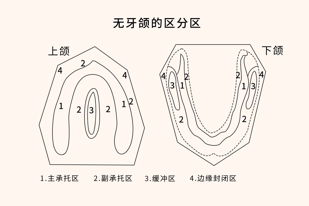 全口义齿无牙颌分区图（全口义齿无牙颌的分区）