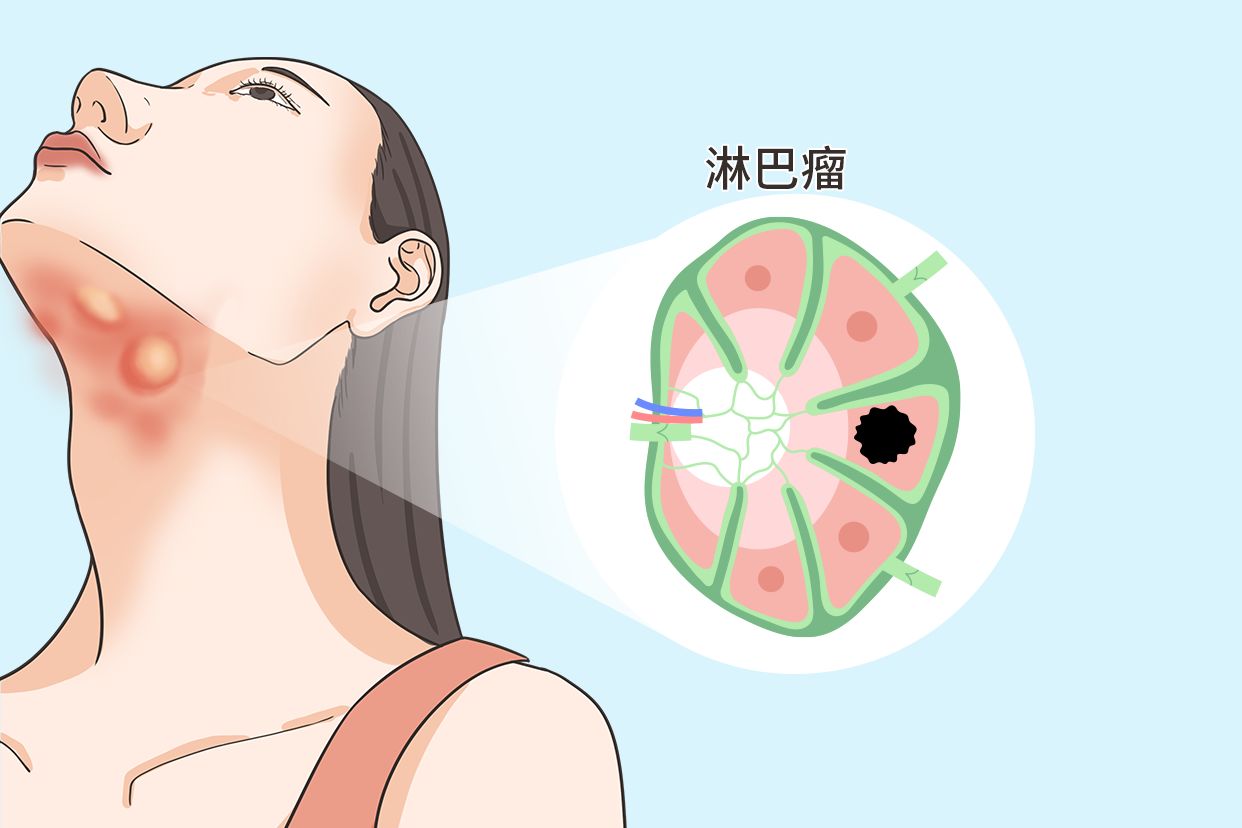 4岁小孩眼睛结膜炎怎么治疗测试 4岁宝宝结膜炎能自愈吗