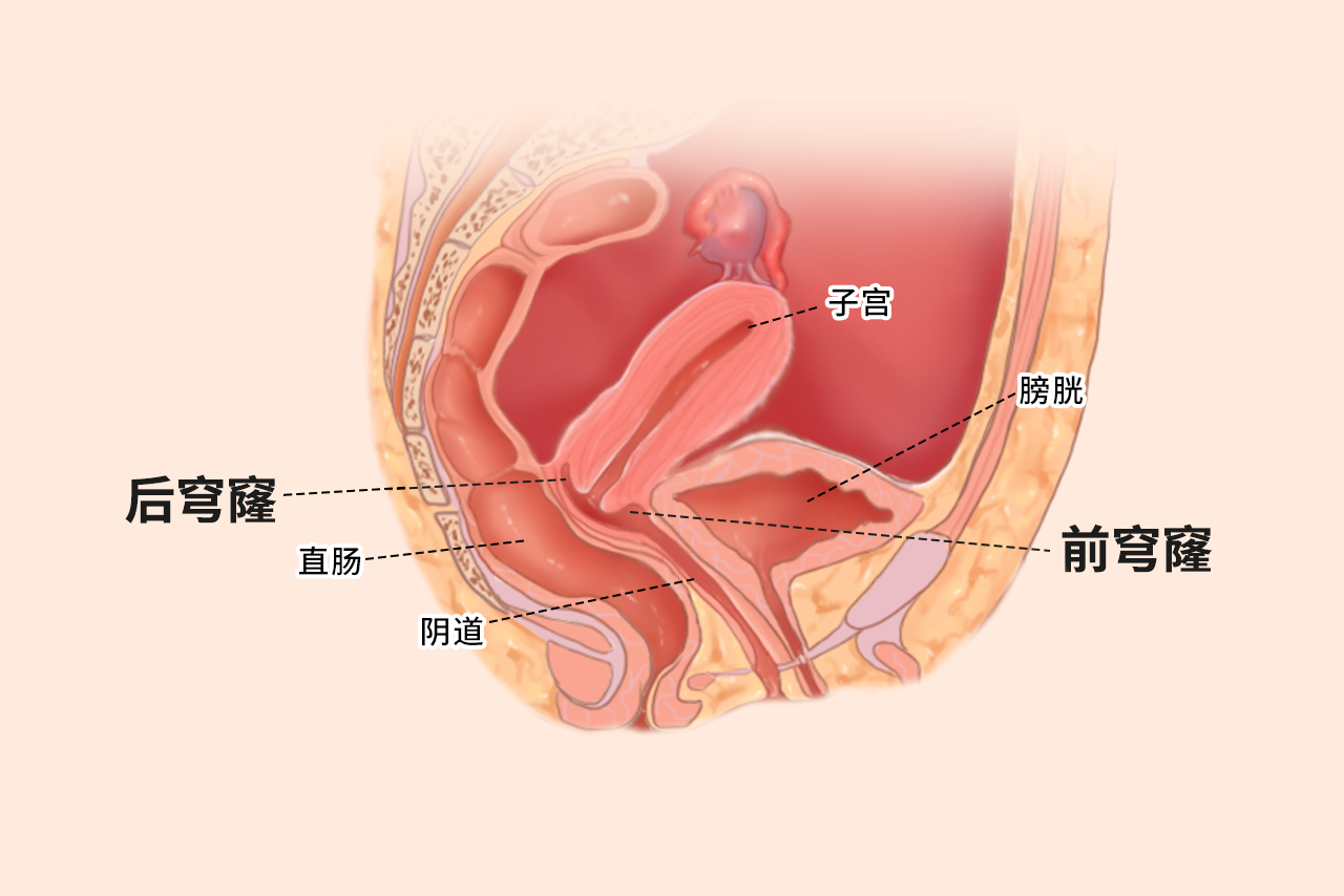 穹隆部位在哪里图片（穹隆和穹窿的区别）