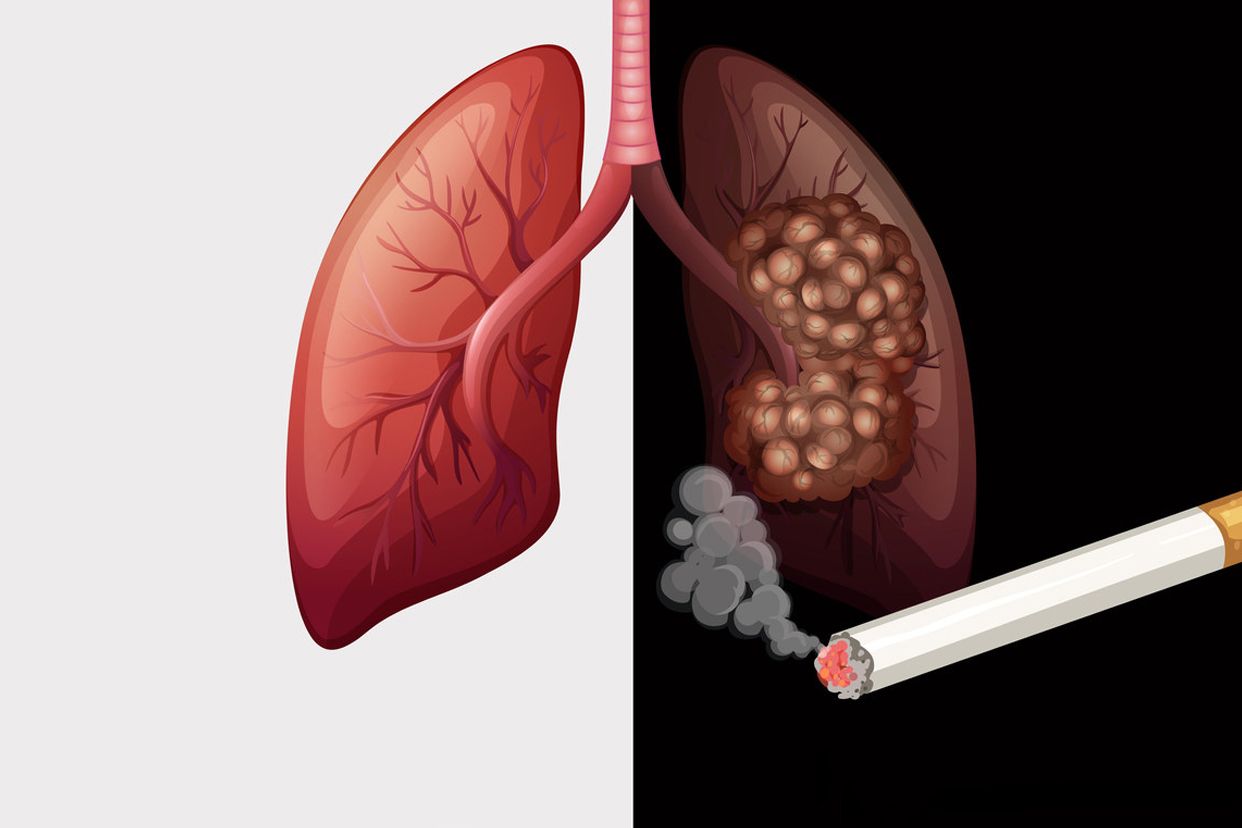 烟草引起癌症的图片 烟草引发癌症的是焦油吗