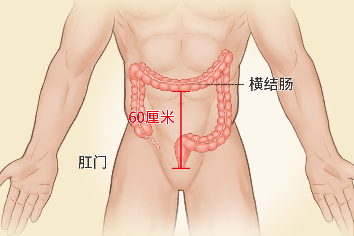 横结肠距肛门60厘米图 横结肠距肛门60厘米有息肉