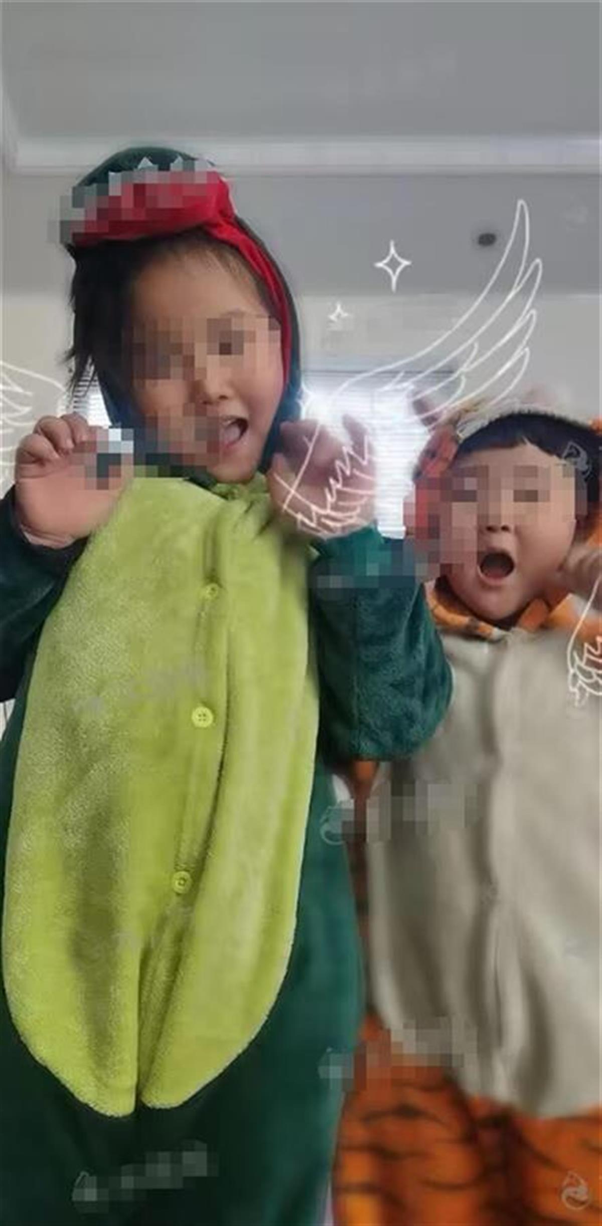 临沂一对年幼姐弟重度烧伤，妈妈和四名姨妈剃光头捐皮，姐姐已顺利完成手术